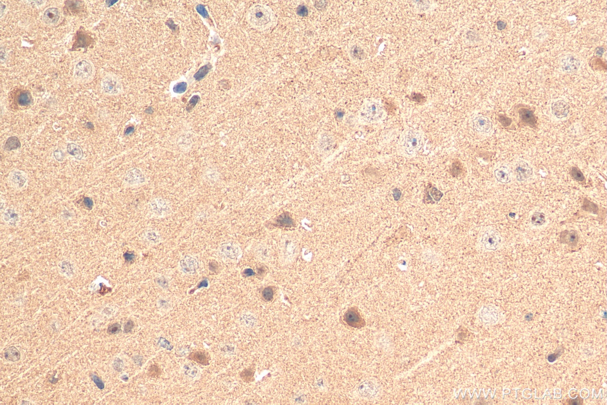 IHC staining of mouse brain using 17885-1-AP