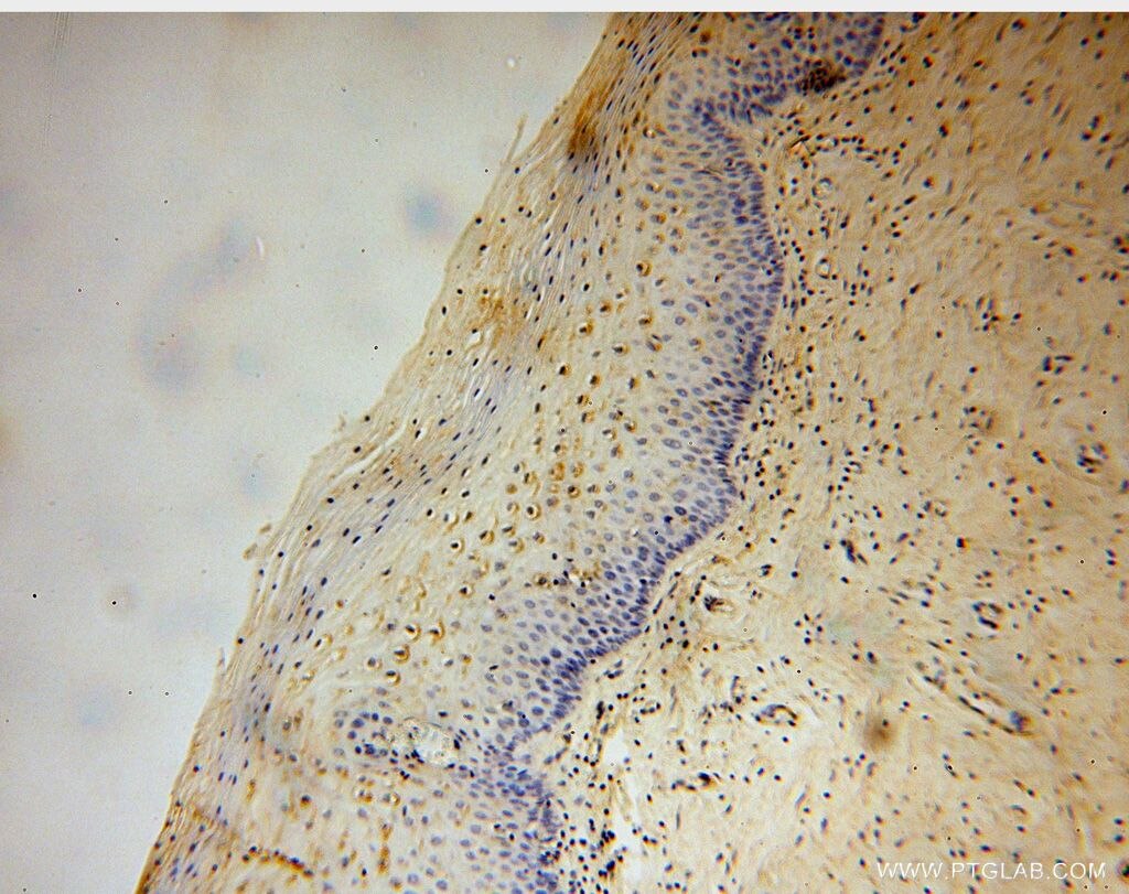 IHC staining of human cervix using 17885-1-AP