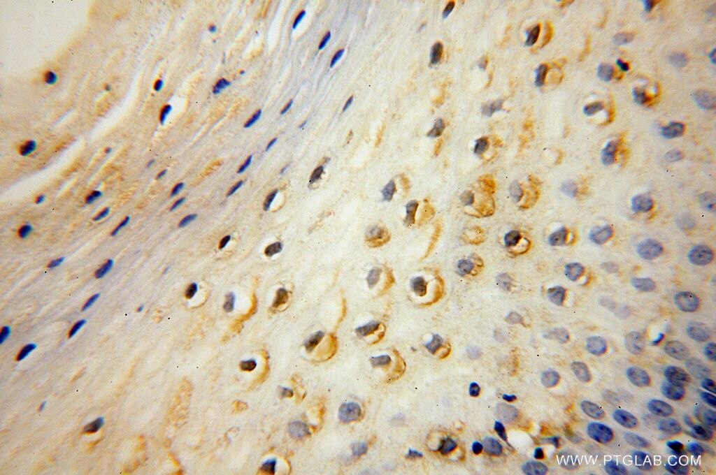 Immunohistochemistry (IHC) staining of human cervix tissue using DGKQ Polyclonal antibody (17885-1-AP)