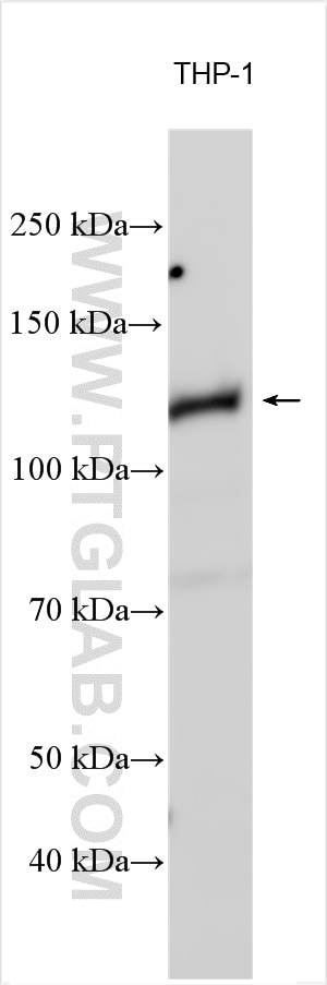 Western Blot (WB) analysis of various lysates using DGKQ Polyclonal antibody (17885-1-AP)