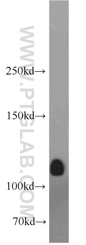 Western Blot (WB) analysis of mouse brain tissue using DGKQ Polyclonal antibody (17885-1-AP)