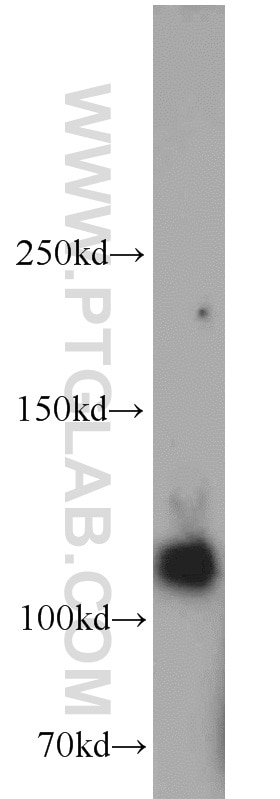 Western Blot (WB) analysis of human placenta tissue using DGKQ Polyclonal antibody (17885-1-AP)