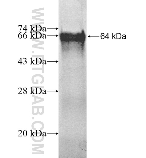 DGKQ fusion protein Ag11817 SDS-PAGE