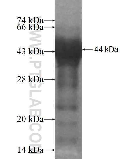 DGKQ fusion protein Ag11938 SDS-PAGE