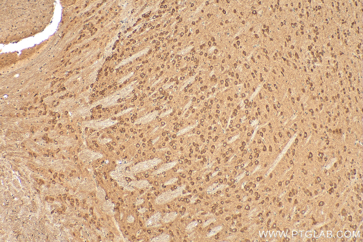 Immunohistochemistry (IHC) staining of mouse brain tissue using DGKZ Polyclonal antibody (32124-1-AP)