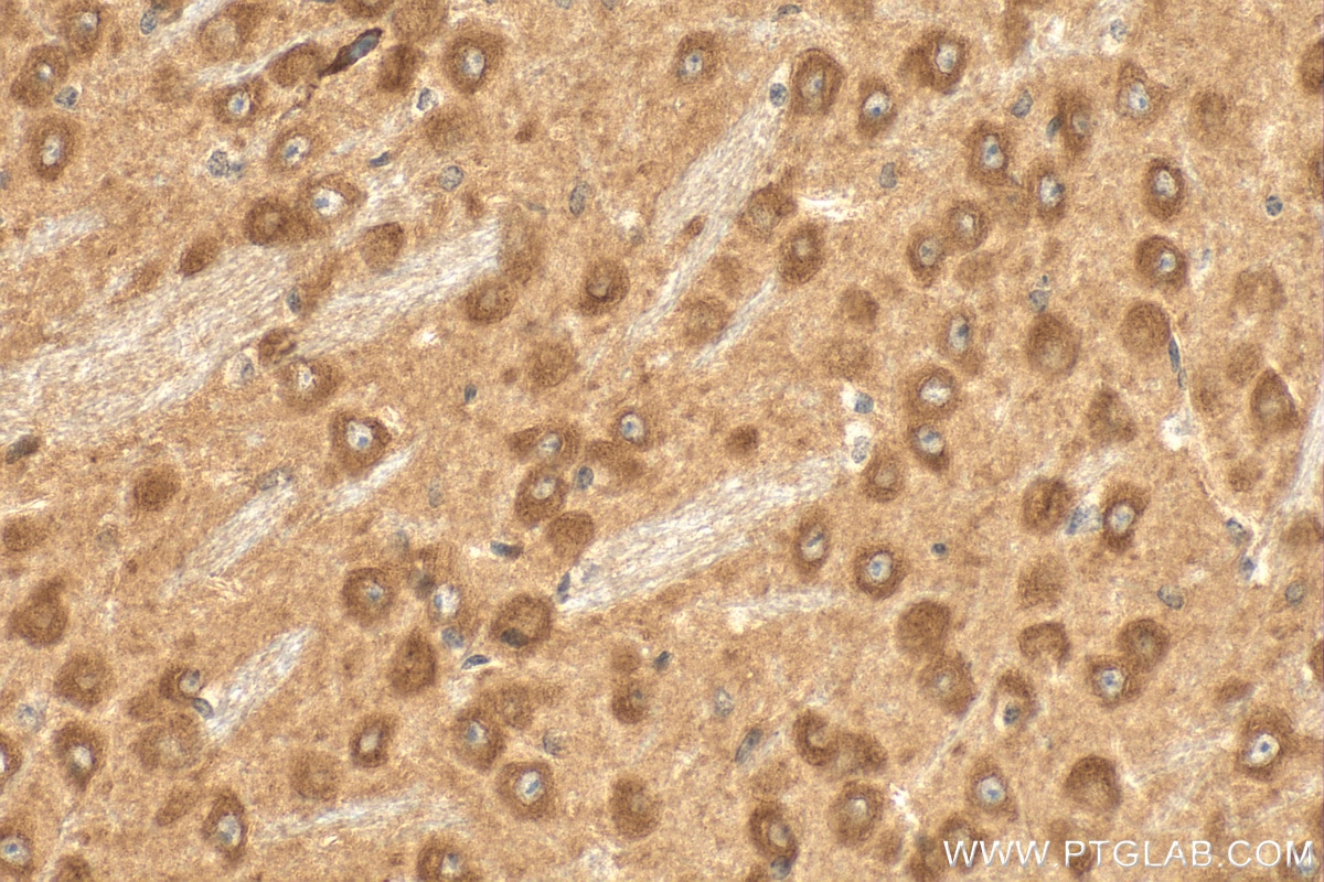 Immunohistochemistry (IHC) staining of mouse brain tissue using DGKZ Polyclonal antibody (32124-1-AP)
