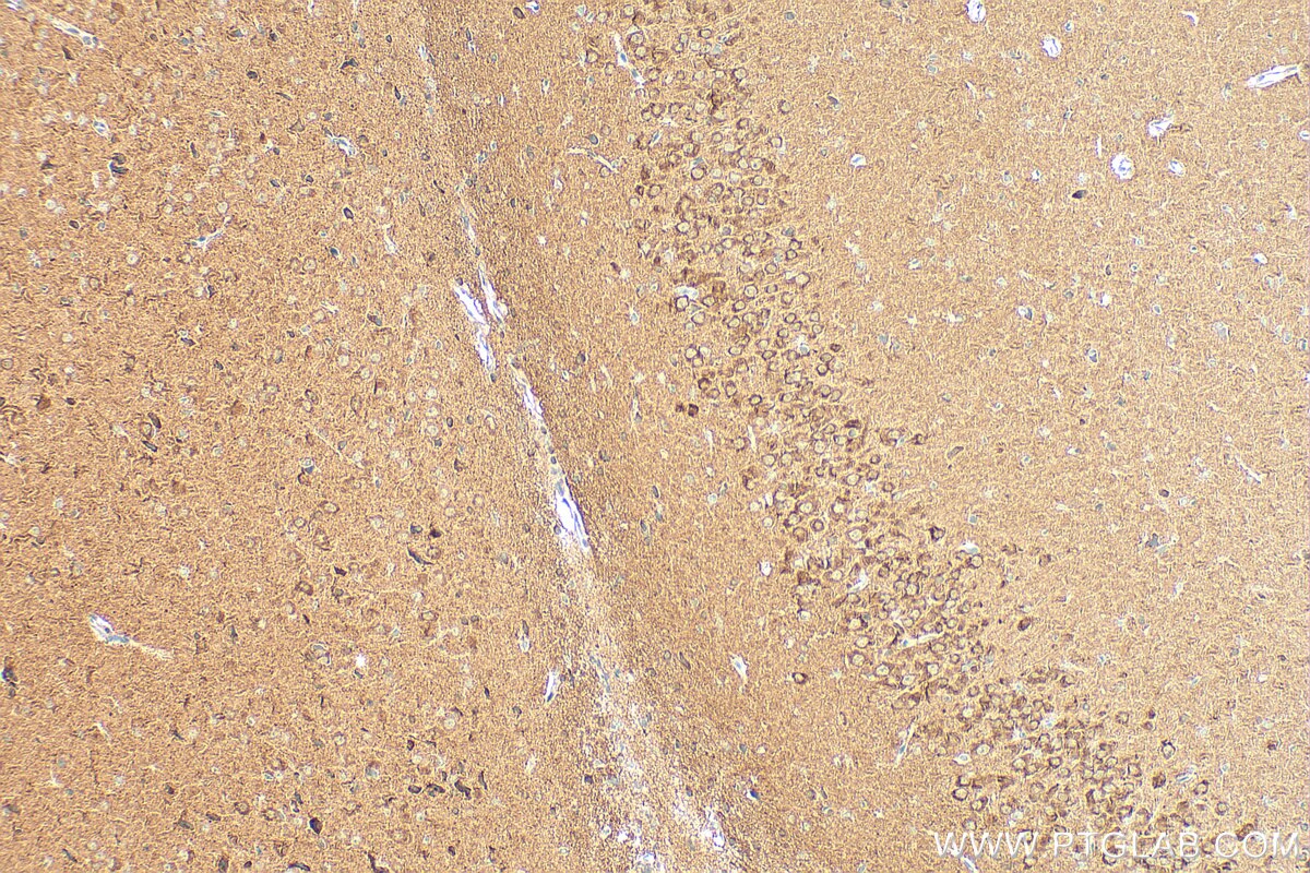 Immunohistochemistry (IHC) staining of rat brain tissue using DGKZ Polyclonal antibody (32124-1-AP)