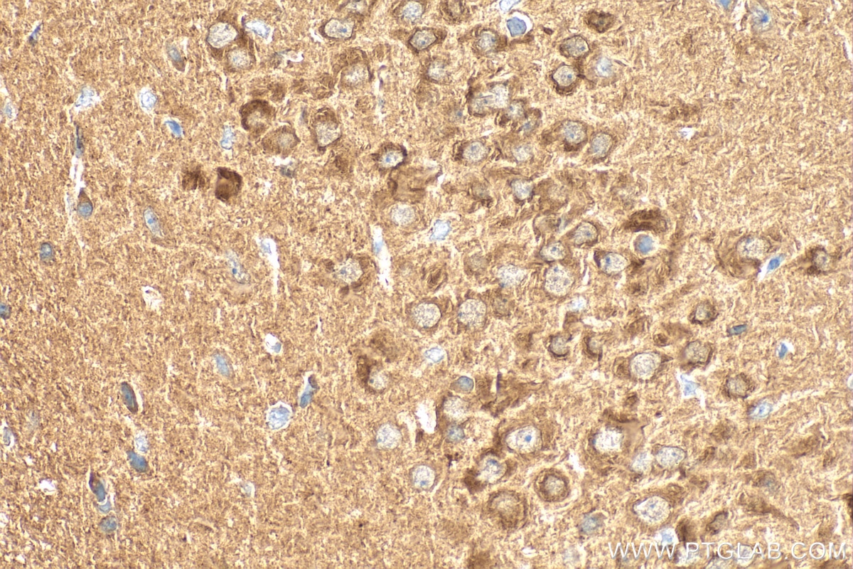 Immunohistochemistry (IHC) staining of rat brain tissue using DGKZ Polyclonal antibody (32124-1-AP)
