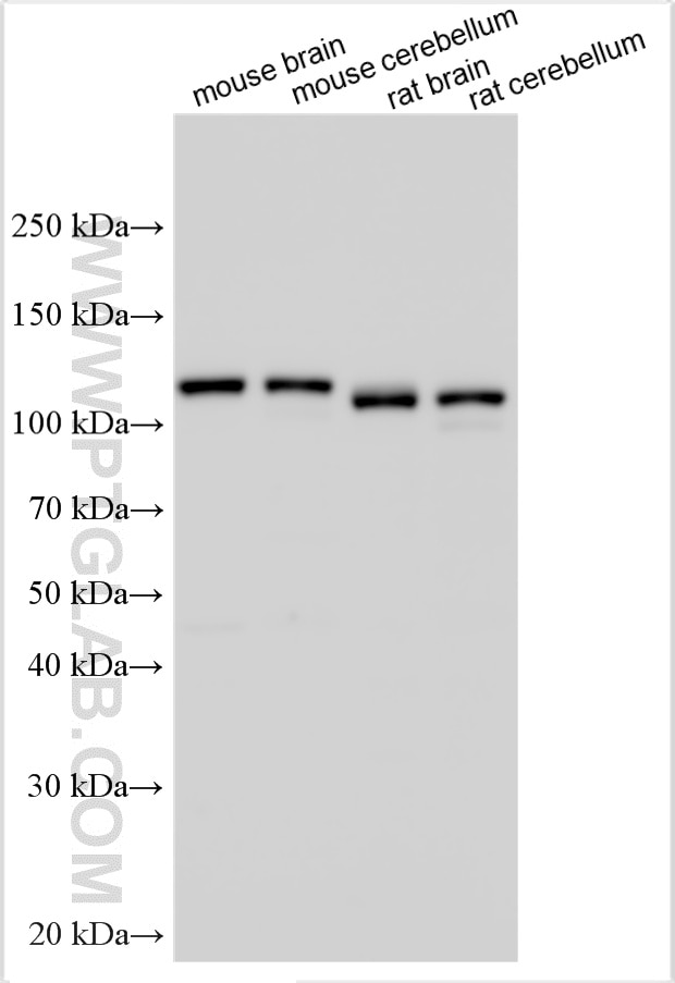 Western Blot (WB) analysis of various lysates using DGKZ Polyclonal antibody (32124-1-AP)