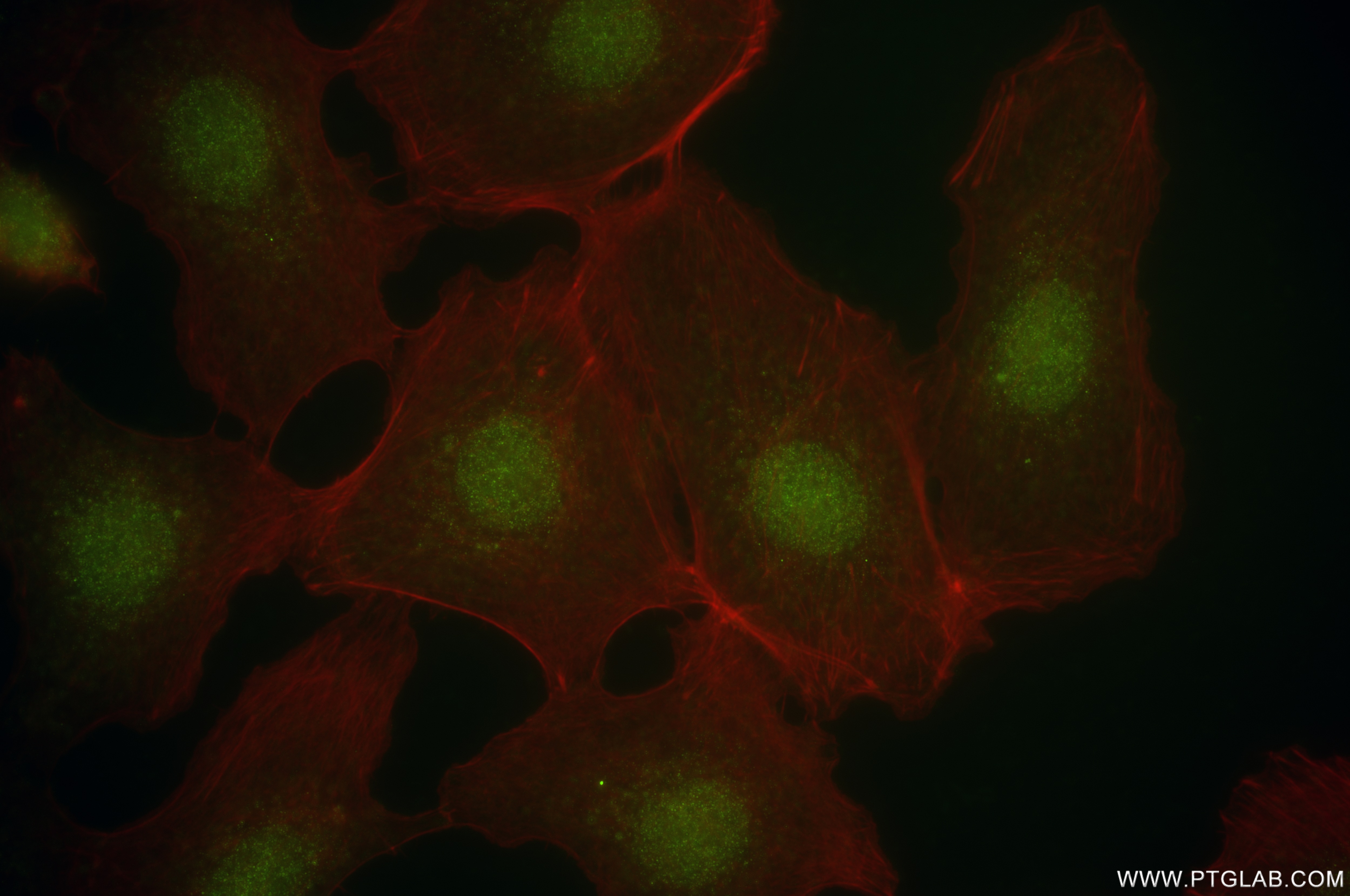 Immunofluorescence (IF) / fluorescent staining of A431 cells using DGKZ Recombinant antibody (84830-5-RR)