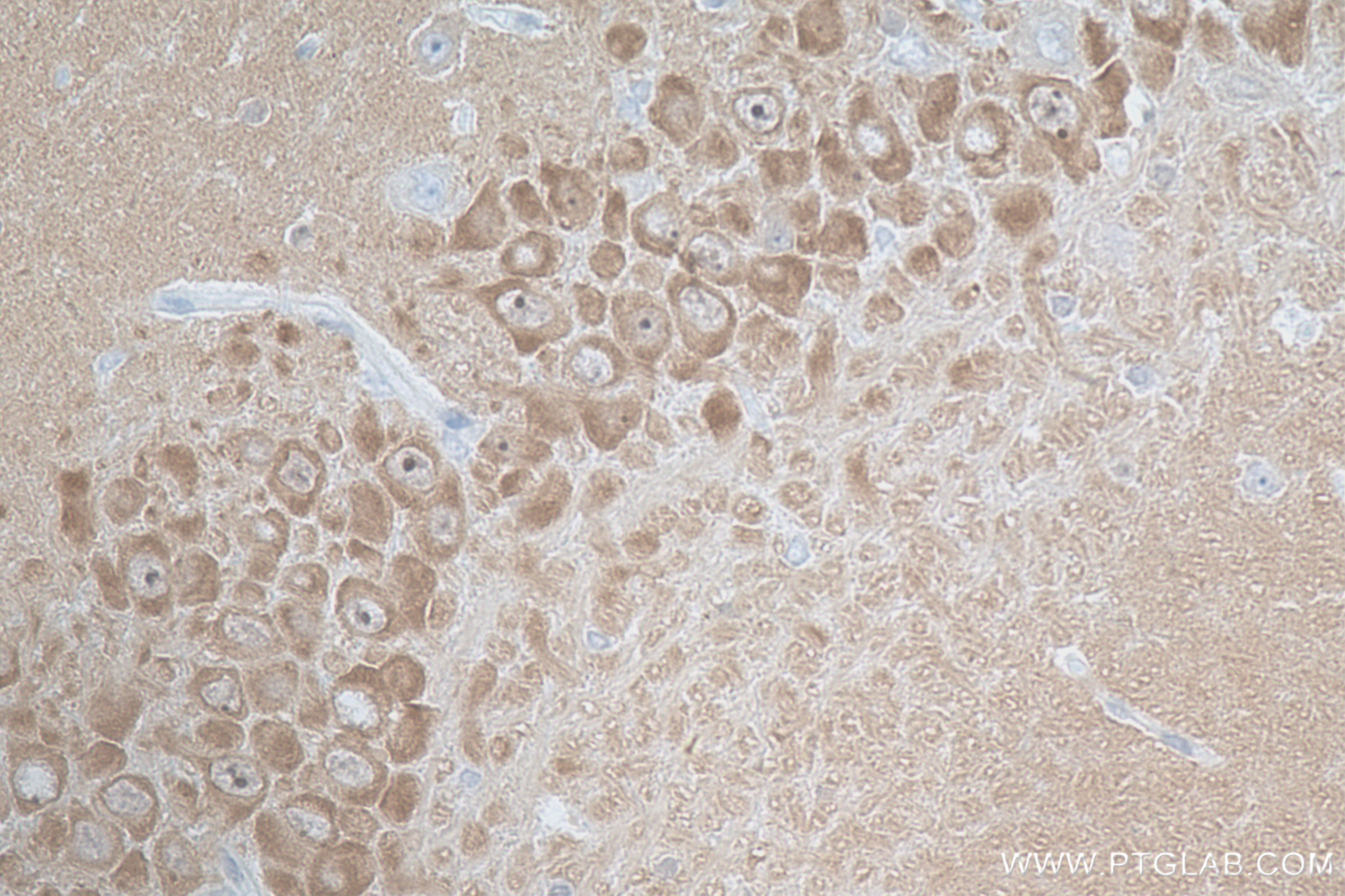 Immunohistochemistry (IHC) staining of rat brain tissue using DGKZ Recombinant antibody (84830-5-RR)