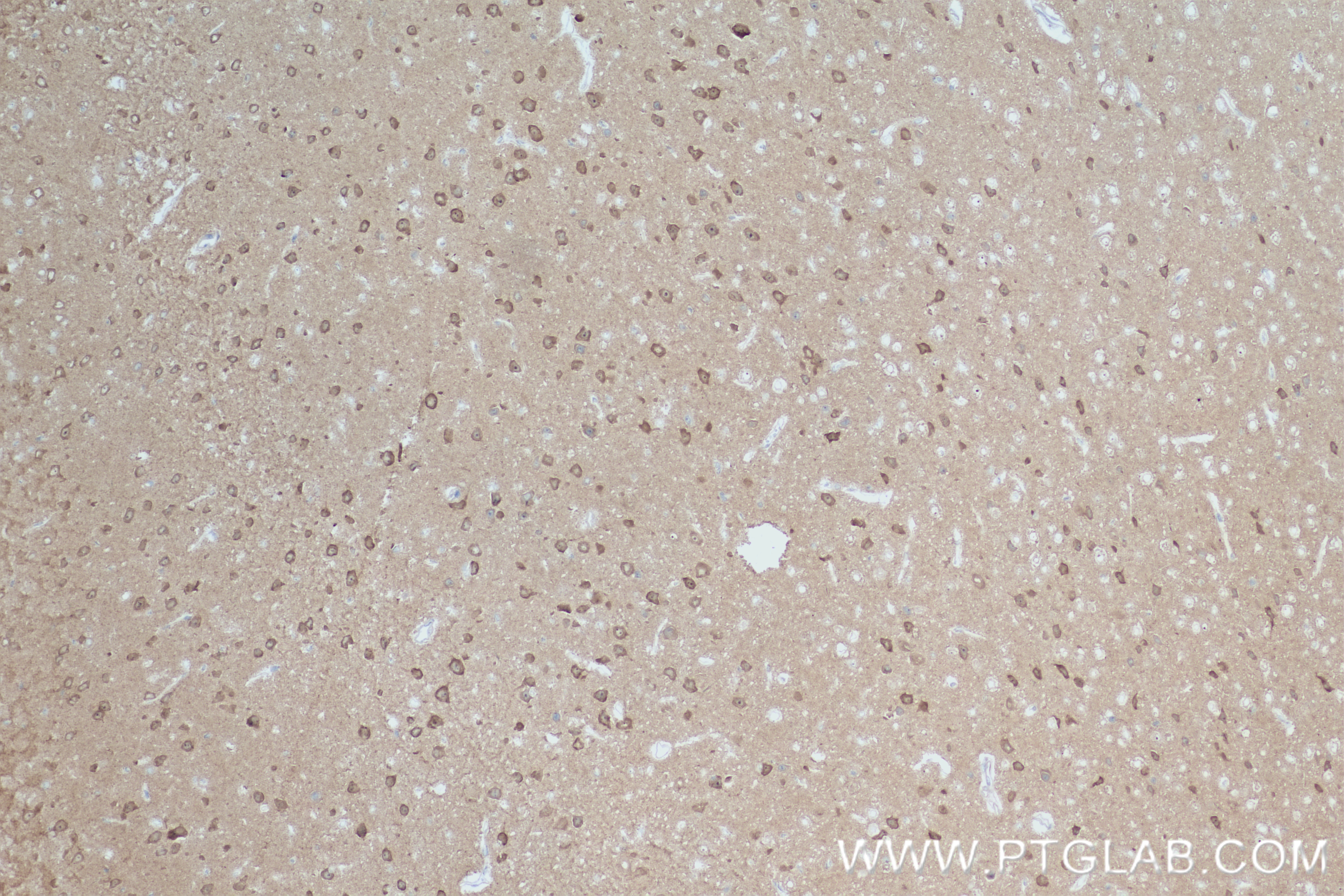 Immunohistochemistry (IHC) staining of mouse brain tissue using DGKZ Recombinant antibody (84830-5-RR)