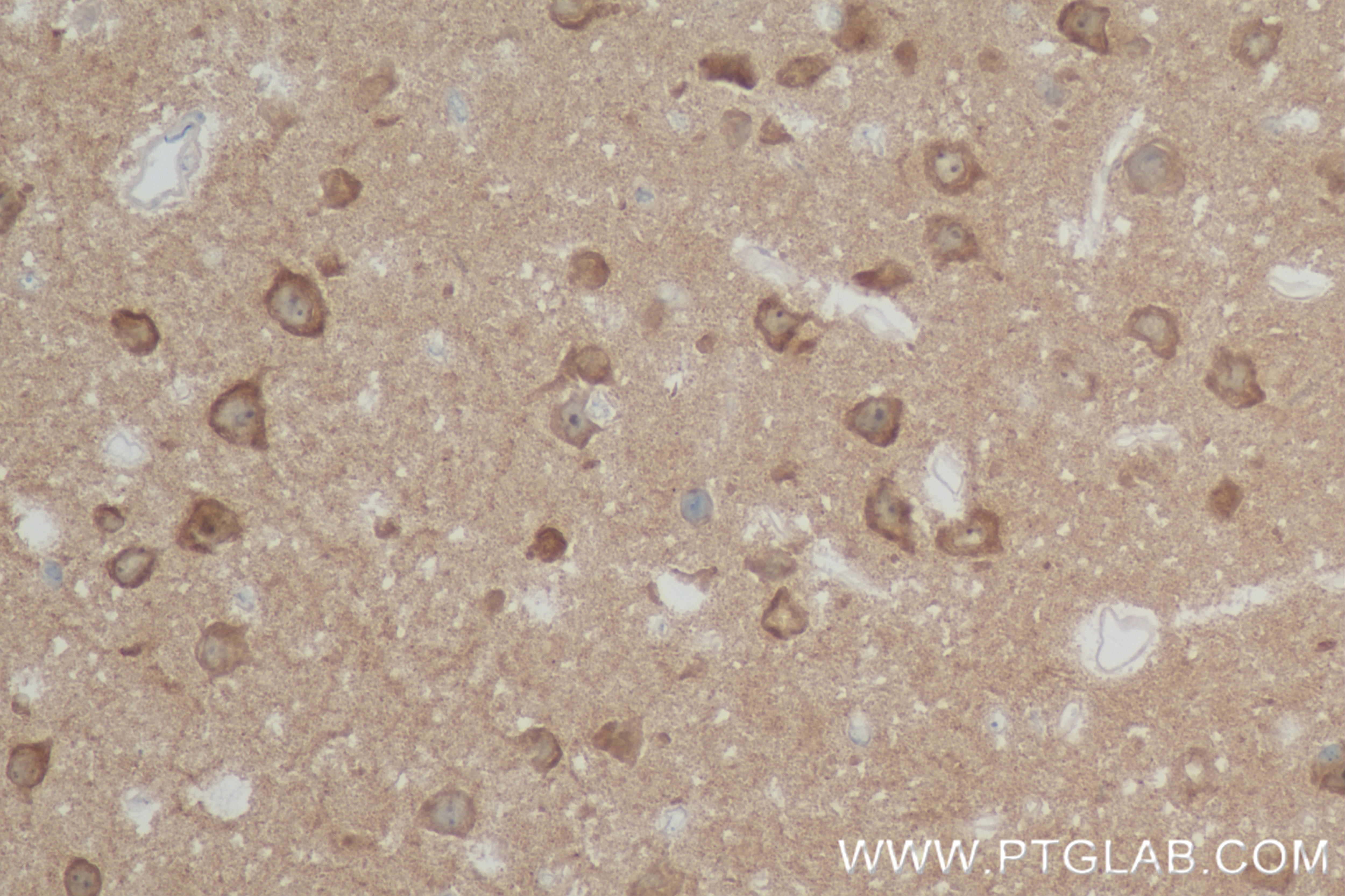 Immunohistochemistry (IHC) staining of mouse brain tissue using DGKZ Recombinant antibody (84830-5-RR)
