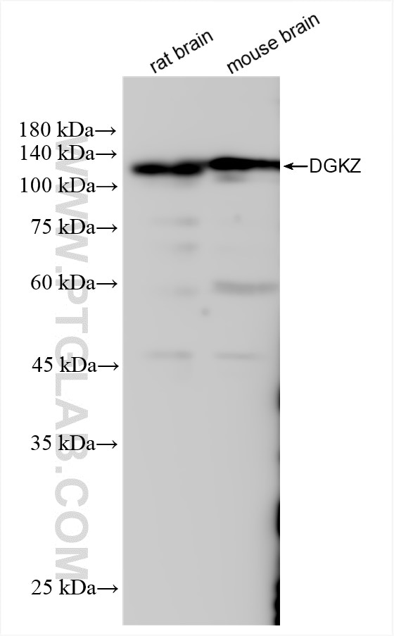 Western Blot (WB) analysis of various lysates using DGKZ Recombinant antibody (84830-5-RR)