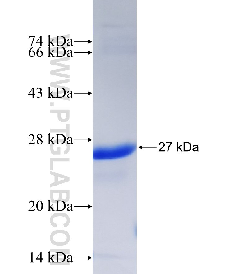 DGKZ fusion protein Ag37327 SDS-PAGE DGKZ fusion protein Ag37327 SDS-PAGE