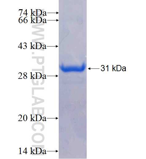 DGKZ fusion protein Ag5074 SDS-PAGE