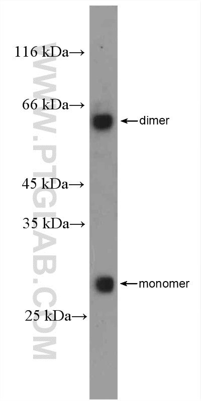Western Blot (WB) analysis of mouse kidney tissue using dGK Polyclonal antibody (16314-1-AP)