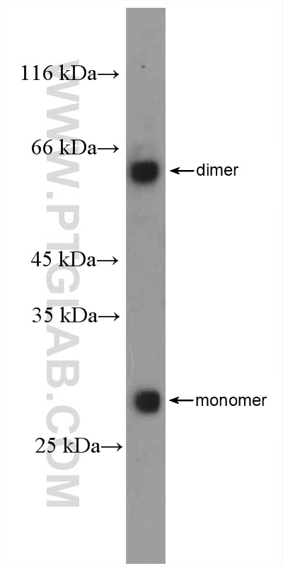 WB analysis of mouse kidney using 16314-1-AP