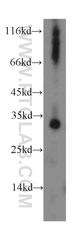Western Blot (WB) analysis of mouse kidney tissue using dGK Polyclonal antibody (16314-1-AP)