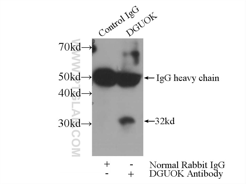 Immunoprecipitation (IP) experiment of mouse kidney tissue using dGK Polyclonal antibody (16459-1-AP)