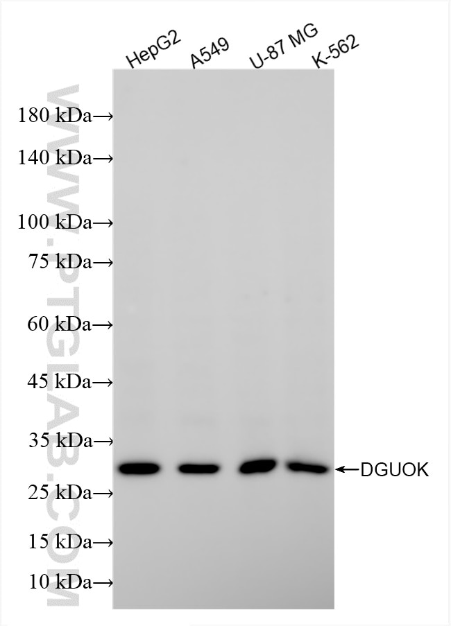 Western Blot (WB) analysis of various lysates using DGUOK Recombinant antibody (85932-2-RR)