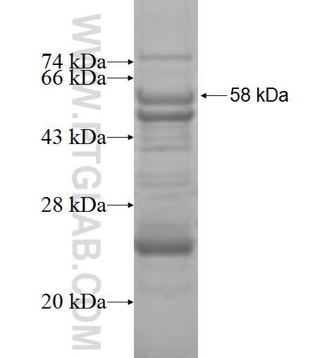DGUOK fusion protein Ag9361 SDS-PAGE