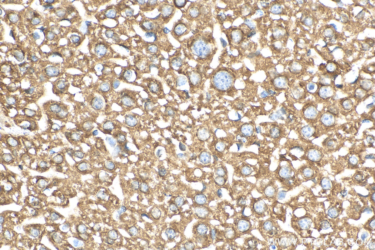 Immunohistochemistry (IHC) staining of mouse liver tissue using DHCR24 Polyclonal antibody (10471-1-AP)
