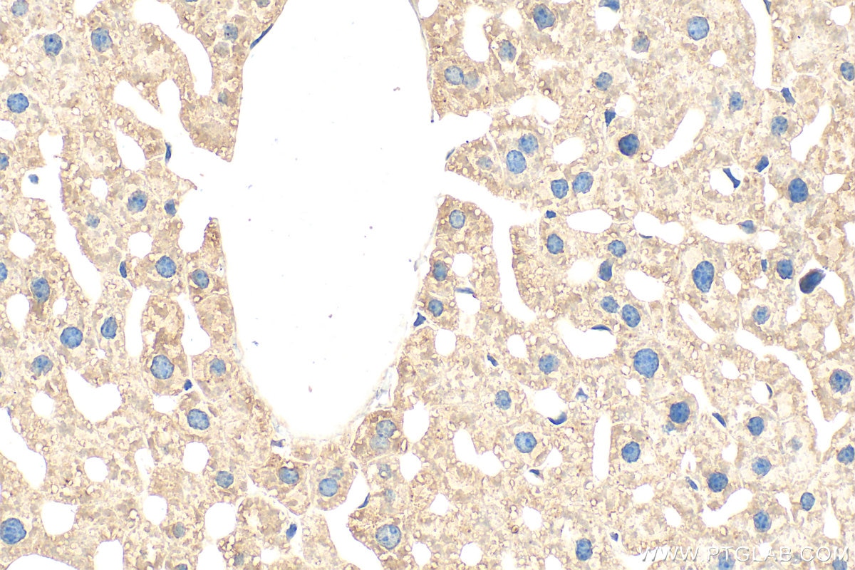 Immunohistochemistry (IHC) staining of mouse liver tissue using DHCR24 Polyclonal antibody (10471-1-AP)