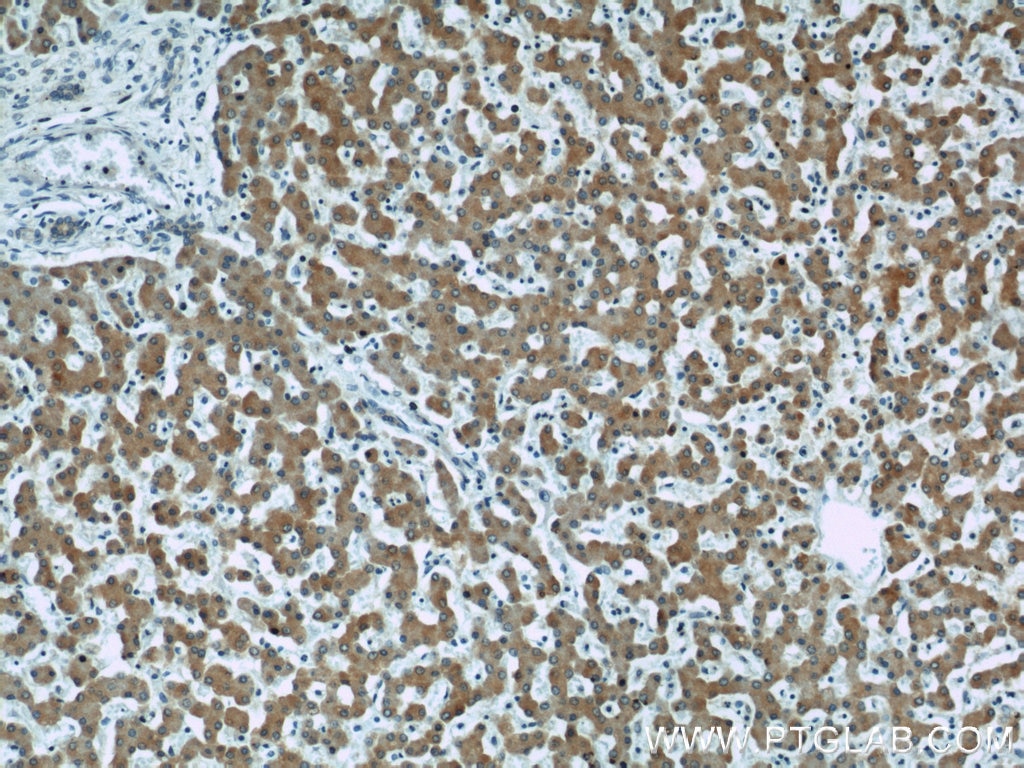 Immunohistochemistry (IHC) staining of human liver tissue using DHCR24 Polyclonal antibody (10471-1-AP)
