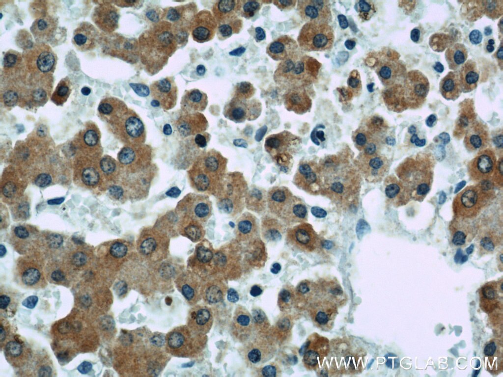 Immunohistochemistry (IHC) staining of human liver tissue using DHCR24 Polyclonal antibody (10471-1-AP)