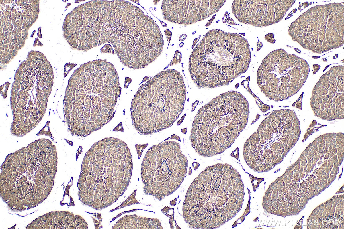 Immunohistochemistry (IHC) staining of mouse testis tissue using DHDDS Polyclonal antibody (15099-1-AP)
