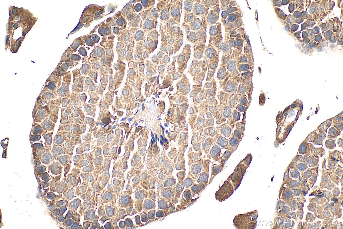 Immunohistochemistry (IHC) staining of mouse testis tissue using DHDDS Polyclonal antibody (15099-1-AP)
