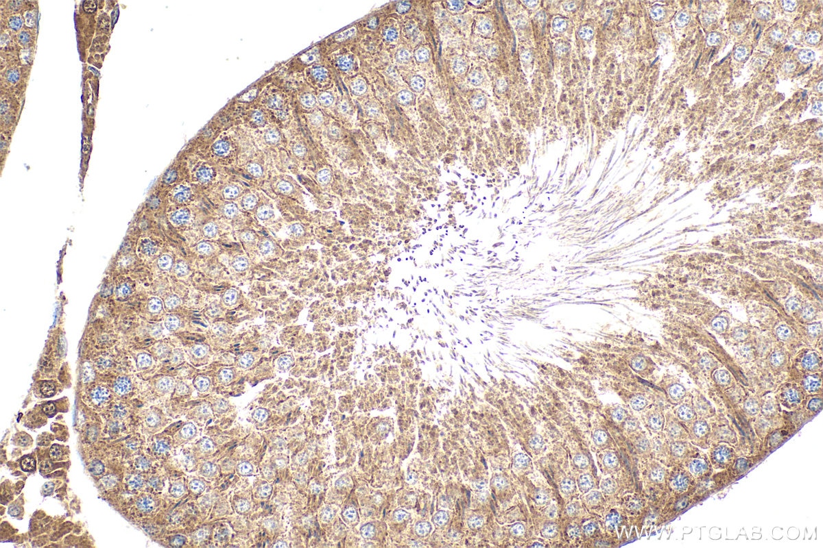 Immunohistochemistry (IHC) staining of rat testis tissue using DHDDS Polyclonal antibody (15099-1-AP)