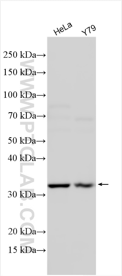 Western Blot (WB) analysis of various lysates using DHDDS Polyclonal antibody (15099-1-AP)
