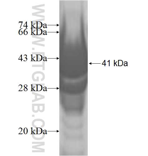 DHDDS fusion protein Ag7421 SDS-PAGE