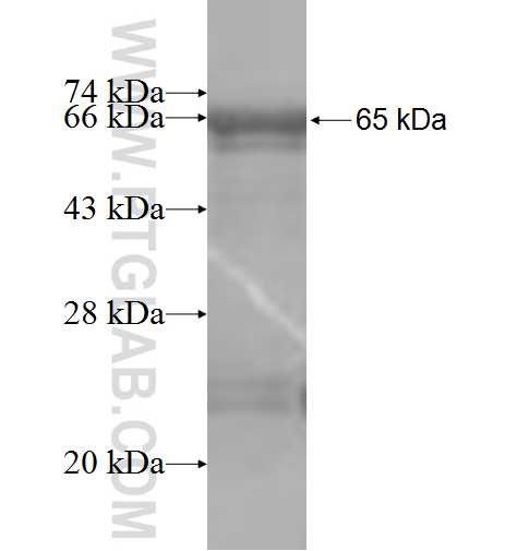 DHDDS fusion protein Ag7426 SDS-PAGE