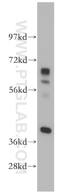 Western Blot (WB) analysis of mouse testis tissue using DHDH Polyclonal antibody (13900-1-AP)