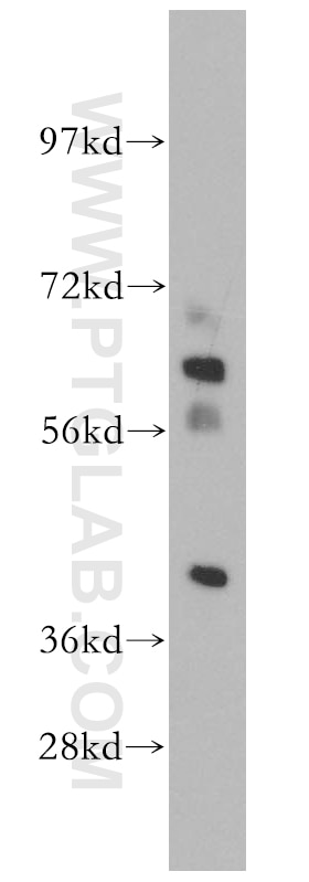 Western Blot (WB) analysis of mouse testis tissue using DHDH Polyclonal antibody (13900-1-AP)
