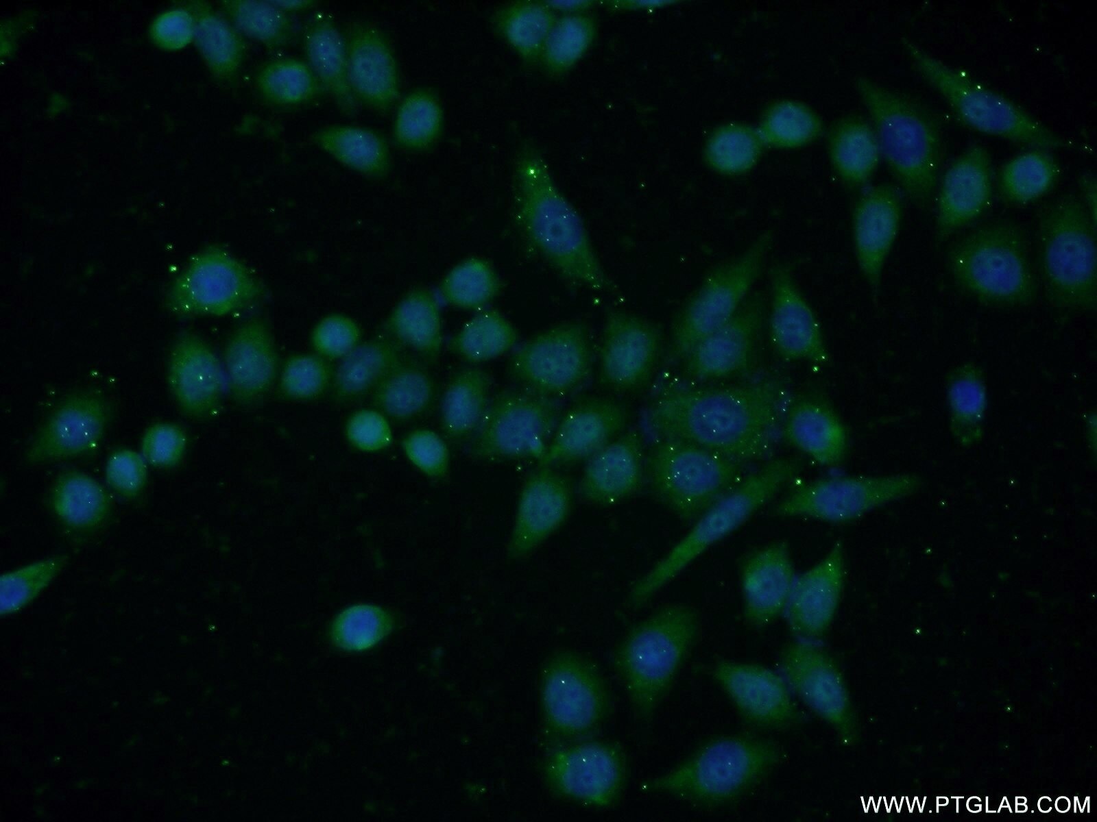 Immunofluorescence (IF) / fluorescent staining of HeLa cells using DHFR Polyclonal antibody (15194-1-AP)