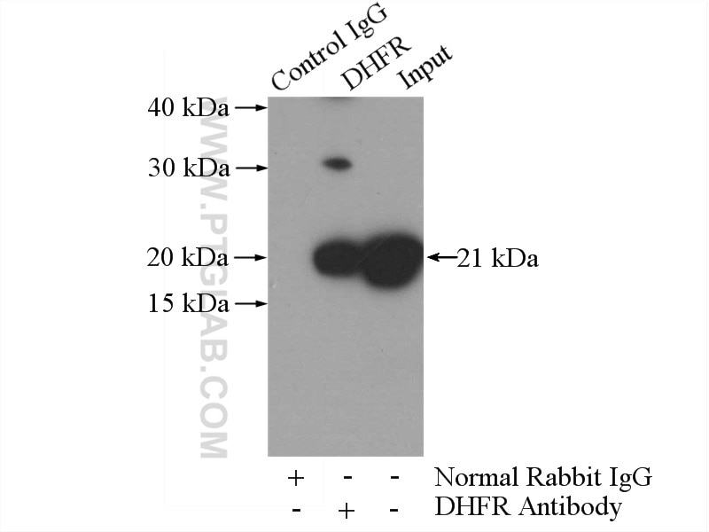 Immunoprecipitation (IP) experiment of Raji cells using DHFR Polyclonal antibody (15194-1-AP)