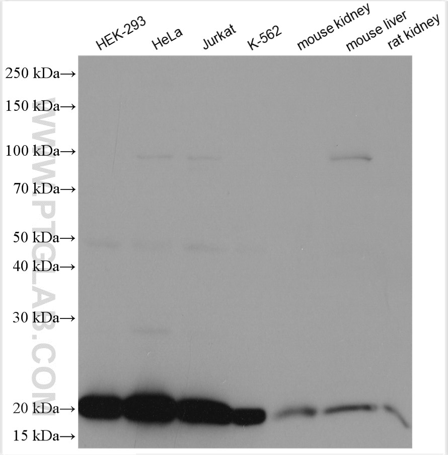 Western Blot (WB) analysis of various lysates using DHFR Polyclonal antibody (15194-1-AP)