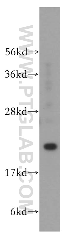 Western Blot (WB) analysis of HeLa cells using DHFR Polyclonal antibody (15194-1-AP)