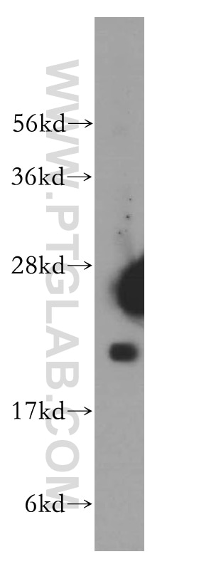 Western Blot (WB) analysis of Raji cells using DHFR Polyclonal antibody (15194-1-AP)