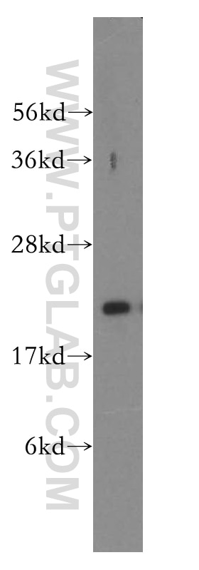 Western Blot (WB) analysis of Jurkat cells using DHFR Polyclonal antibody (15194-1-AP)