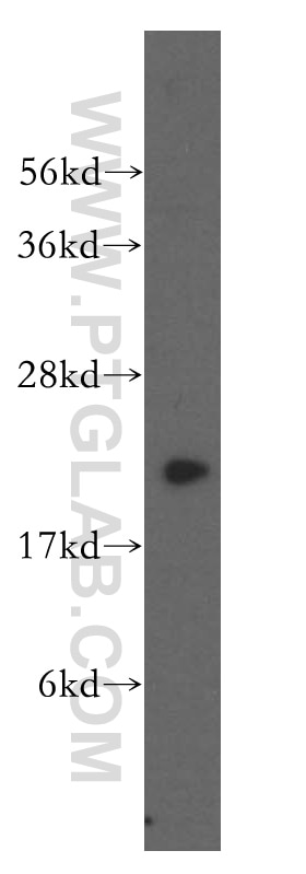 Western Blot (WB) analysis of K-562 cells using DHFR Polyclonal antibody (15194-1-AP)
