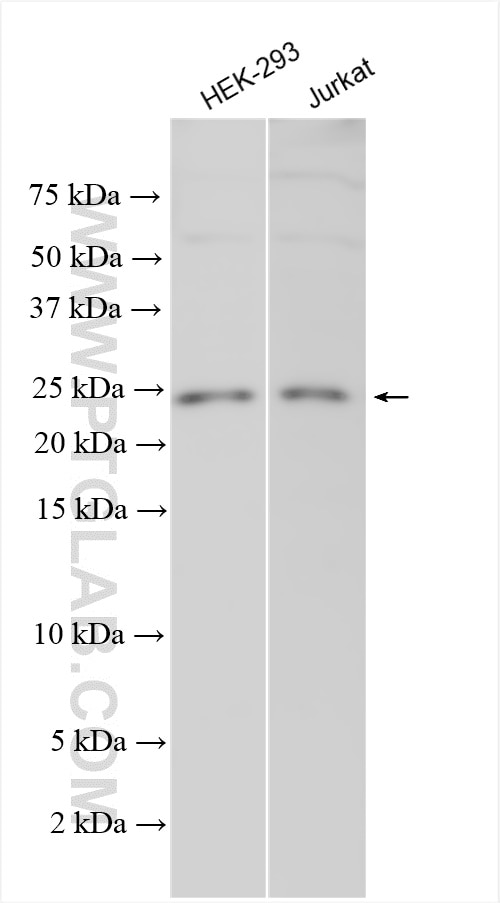 Western Blot (WB) analysis of various lysates using DHFRL1 Polyclonal antibody (27965-1-AP)