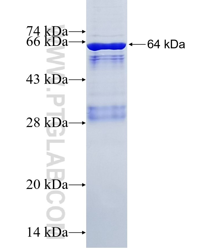 DHH fusion protein Ag4850 SDS-PAGE
