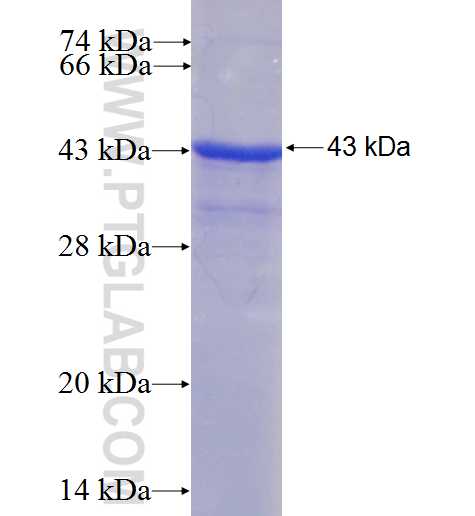 DHH fusion protein Ag5212 SDS-PAGE