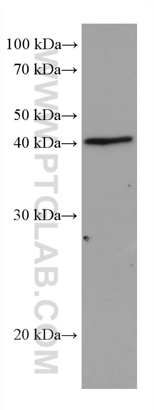 WB analysis of 4T1 using 67977-1-Ig