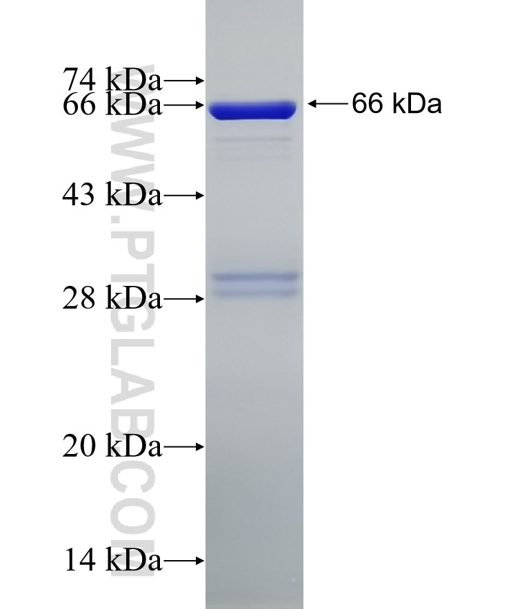 DHODH fusion protein Ag6649 SDS-PAGE